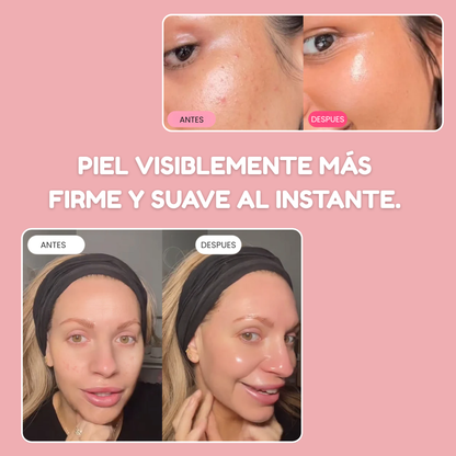 Gelcrem™